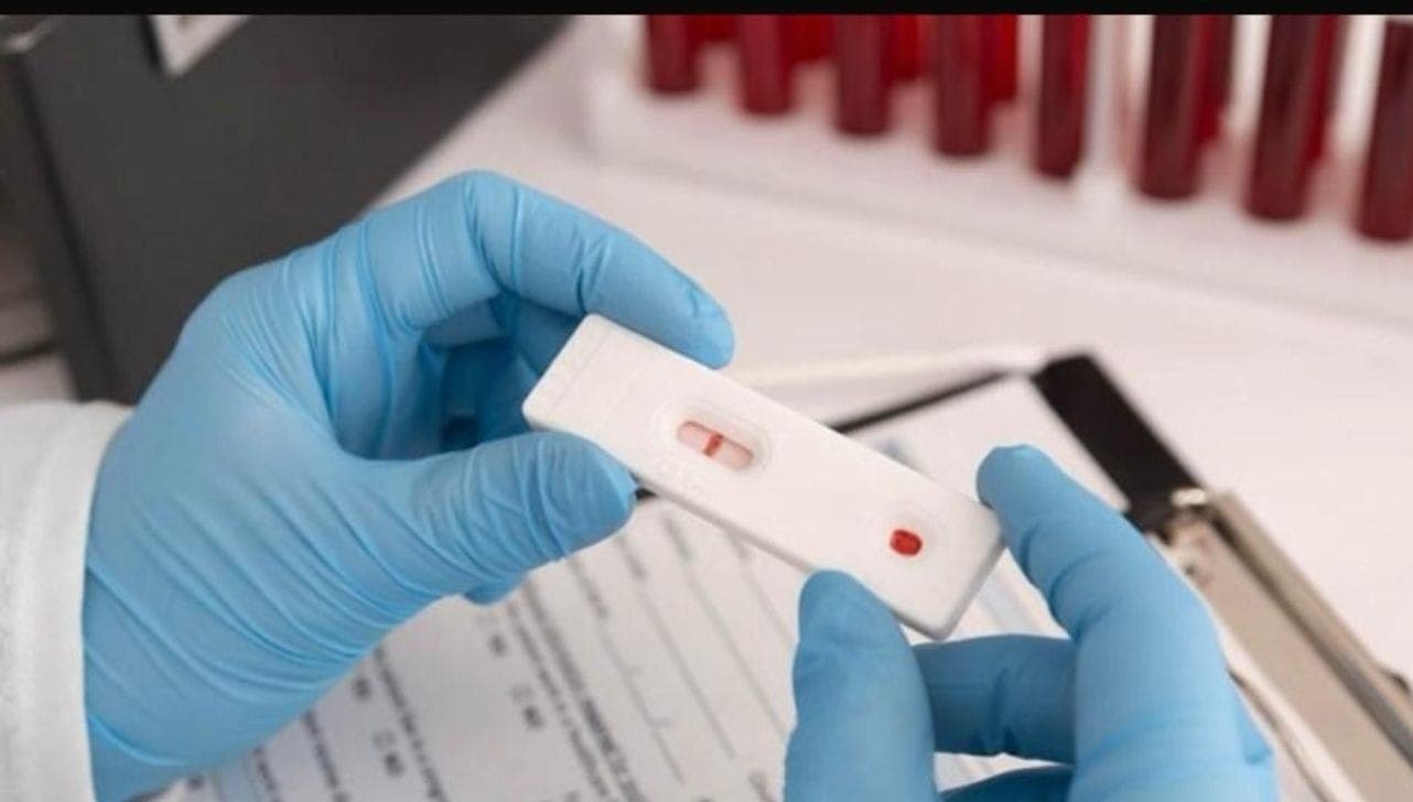 Ação começa às 14 horas