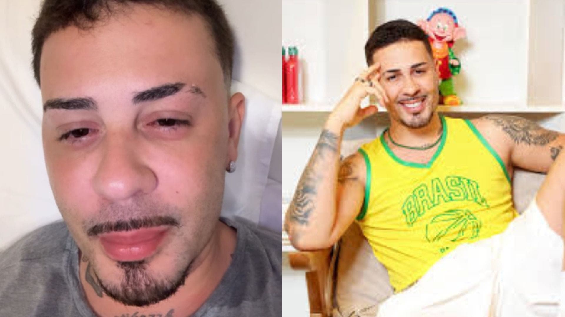 Carlinhos Maia está com conjuntivite