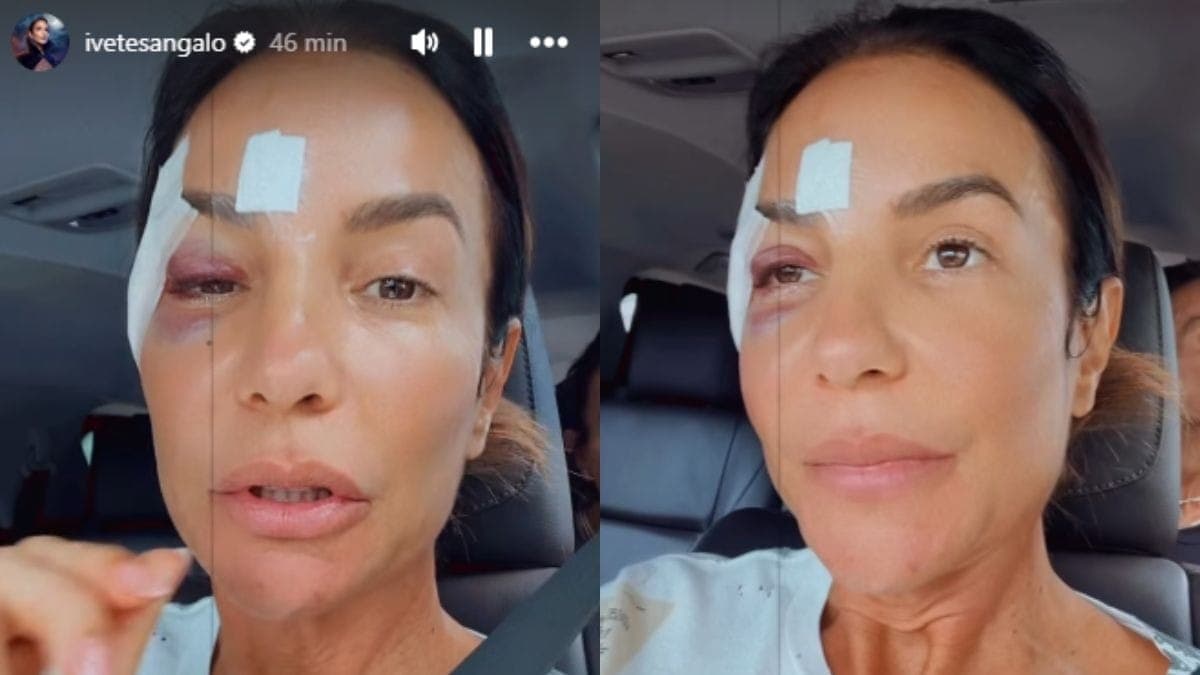 Ivete Sangalo saiu do hospital