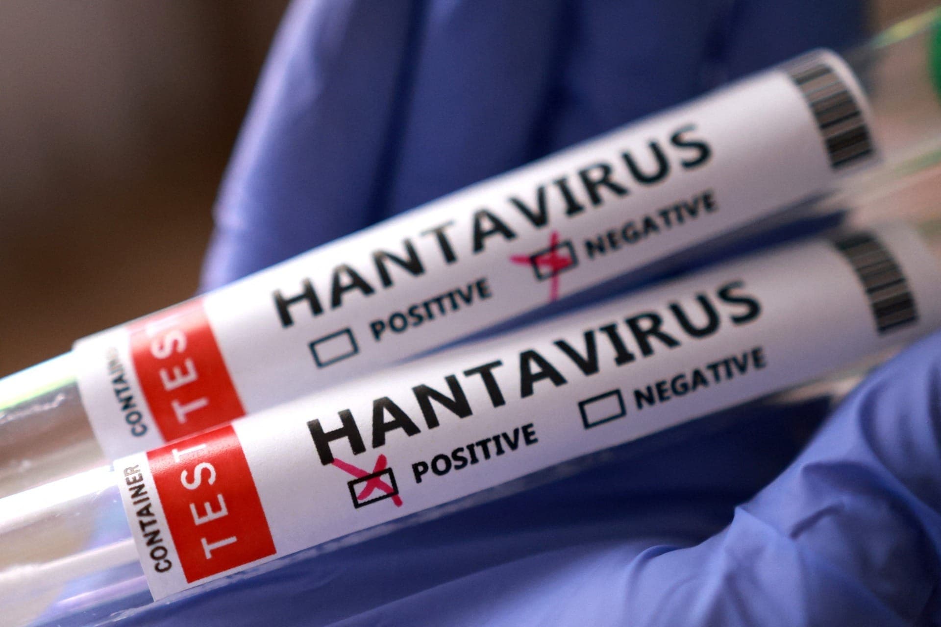 Hantavírus