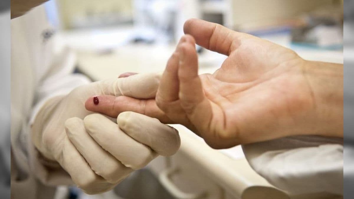 HIV