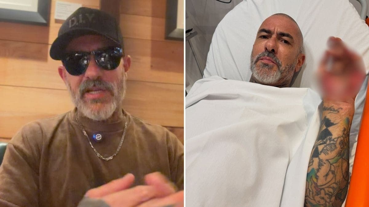 Henrique Fogaça explica acidente de moto e mostra ferimentos